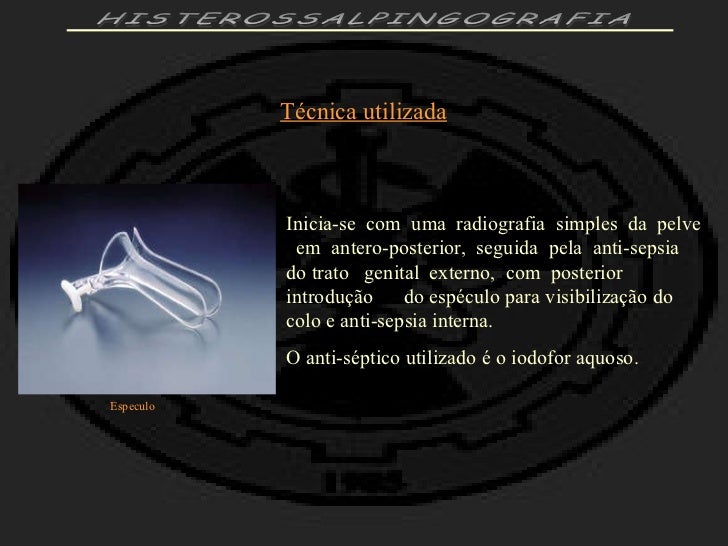 Exame histerossalpingografia preparo