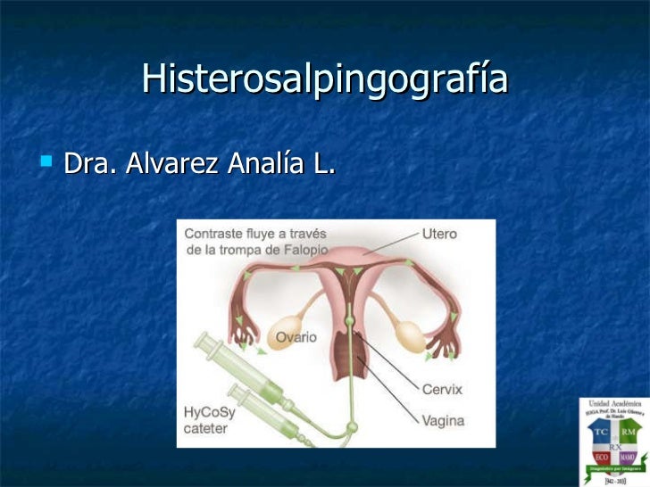 Histerosalpingografia Analia
