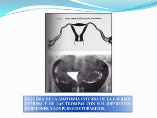 ESQUEMA DE LA ANATOMÍA INTERNA DE LA CAVIDAD
UTERINA Y DE LAS TROMPAS CON SUS DIFERENTES
PORCIONES, Y LOS PLIEGUES TUBÁRICOS.

 