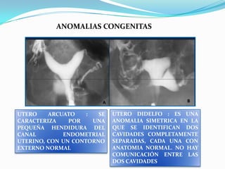 ANOMALIAS CONGENITAS

UTERO
ARCUATO
:
SE
CARACTERIZA
POR
UNA
PEQUEÑA HENDIDURA DEL
CANAL
ENDOMETRIAL
UTERINO, CON UN CONTORNO
EXTERNO NORMAL

UTERO DIDELFO : ES UNA
ANOMALIA SIMETRICA EN LA
QUE SE IDENTIFICAN DOS
CAVIDADES COMPLETAMENTE
SEPARADAS, CADA UNA CON
ANATOMIA NORMAL. NO HAY
COMUNICACIÓN ENTRE LAS
DOS CAVIDADES

 