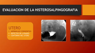 EVALUACION DE LA HISTEROSALPINGOGRAFIA
UTERO
 ANOMALIAS CONGENITAS
 DEFECTOS DE LLENADO.
 CONTORNO DEL UTERO
 