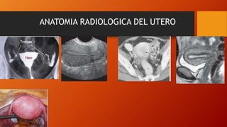 ANATOMIA RADIOLOGICA DEL UTERO
 
