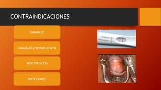 CONTRAINDICACIONES
EMBARAZO
SANGRADO UTERINO ACTIVO
MENSTRUACION
INFECCIONES
 