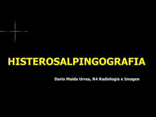 HISTEROSALPINGOGRAFIA   Dario Maida Urrea, R4 Radiología e Imagen 