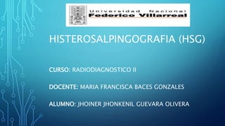 HISTEROSALPINGOGRAFIA (HSG)
CURSO: RADIODIAGNOSTICO II
DOCENTE: MARIA FRANCISCA BACES GONZALES
ALUMNO: JHOINER JHONKENIL GUEVARA OLIVERA
 