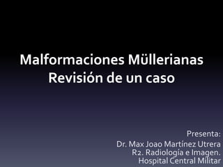 Malformaciones Müllerianas
Revisión de un caso
Presenta:
Dr. Max Joao Martínez Utrera
R2. Radiología e Imagen.
Hospital Central Militar
 