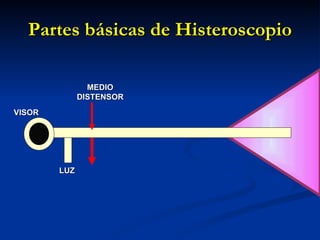 Partes básicas de Histeroscopio LUZ MEDIO DISTENSOR VISOR 
