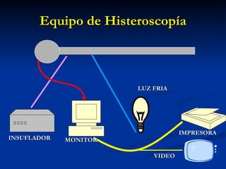 Equipo de Histeroscopía INSUFLADOR MONITOR LUZ FRIA IMPRESORA VIDEO 