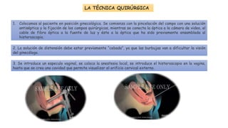 1. Colocamos al paciente en posición ginecológica. Se comienza con la pincelación del campo con una solución
antiséptica y la fijación de los campos quirúrgicos, mientras se conecta la óptica a la cámara de video, el
cable de fibra óptica a la fuente de luz y éste a la óptica que ha sido previamente ensamblada al
histeroscopio.
LA TÉCNICA QUIRÚRGICA
2. La solución de distensión debe estar previamente “cebada”, ya que las burbujas van a dificultar la visión
del ginecólogo.
3. Se introduce un especulo vaginal, se coloca la anestesia local, se introduce el histeroscopio en la vagina,
hasta que se crea una cavidad que permite visualizar el orificio cervical externo.
 