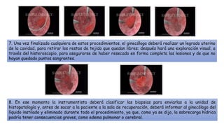 7. Una vez finalizado cualquiera de estos procedimientos, el ginecólogo deberá realizar un legrado uterino
de la cavidad, para retirar los restos de tejido que quedan libres; después hará una exploración visual, a
través del histeroscopio, para asegurarse de haber resecado en forma completa las lesiones y de que no
hayan quedado puntos sangrantes.
8. En ese momento la instrumentista deberá clasificar las biopsias para enviarlas a la unidad de
histopatología y, antes de sacar a la paciente a la sala de recuperación, deberá informar al ginecólogo del
líquido instilado y eliminado durante todo el procedimiento, ya que, como ya se dijo, la sobrecarga hídrica
podría tener consecuencias graves, como edema pulmonar o cerebral.
 