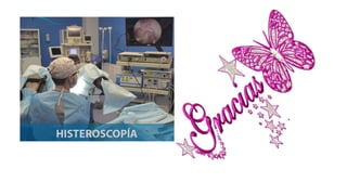 exposicion detallada sobre HISTEROSCOPIA1.pptx