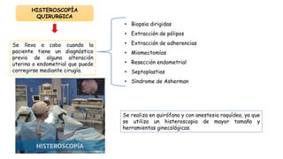 • Biopsia dirigidas
• Extracción de pólipos
• Extracción de adherencias
• Miomectomías
• Resección endometrial
• Septoplastias
• Síndrome de Asherman
HISTEROSCOPÍA
QUIRURGICA
Se realiza en quirófano y con anestesia raquídea, ya que
se utiliza un histeroscopia de mayor tamaño y
herramientas ginecológicas.
Se lleva a cabo cuando la
paciente tiene un diagnóstico
previo de alguna alteración
uterina o endometrial que puede
corregirse mediante cirugía.
 