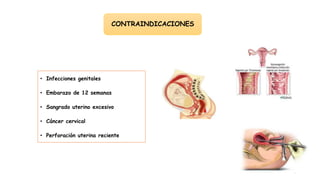 CONTRAINDICACIONES
• Infecciones genitales
• Embarazo de 12 semanas
• Sangrado uterino excesivo
• Cáncer cervical
• Perforación uterina reciente
 