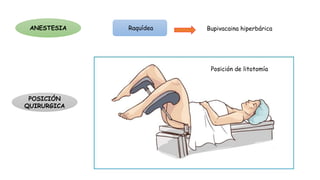 ANESTESIA Raquídea
POSICIÓN
QUIRURGICA
Posición de litotomía
Bupivacaina hiperbárica
 