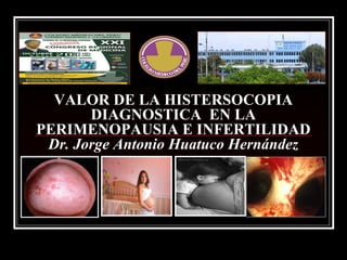 VALOR DE LA HISTERSOCOPIA
DIAGNOSTICA EN LA
PERIMENOPAUSIA E INFERTILIDAD
Dr. Jorge Antonio Huatuco Hernández
 
