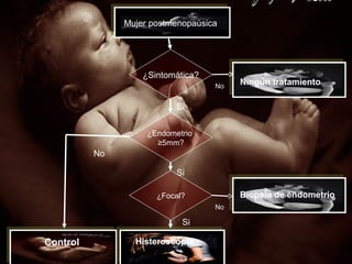 ¿Sintomática?
¿Endometrio
≥5mm?
No
Si
Si
No
Mujer postmenopaùsica
Control Histeroscopìa
Ningún tratamiento
¿Focal? Biopsia de endometrio
Si
No
 