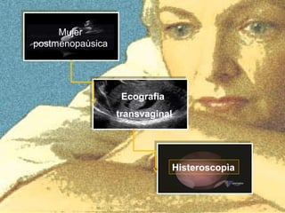 Mujer
postmenopaùsica
Ecografia
transvaginal
Histeroscopìa
 