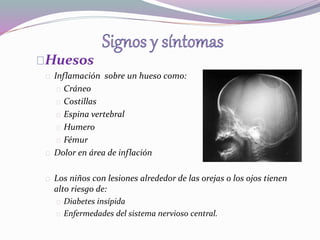 Huesos 
Inflamación sobre un hueso como: 
Cráneo 
Costillas 
Espina vertebral 
Humero 
Fémur 
Dolor en área de inflación 
Los niños con lesiones alrededor de las orejas o los ojos tienen 
alto riesgo de: 
Diabetes insípida 
Enfermedades del sistema nervioso central. 
 
