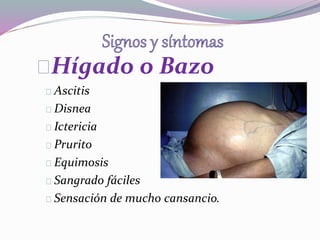 Hígado o Bazo 
Ascitis 
Disnea 
Ictericia 
Prurito 
Equimosis 
Sangrado fáciles 
Sensación de mucho cansancio. 
 