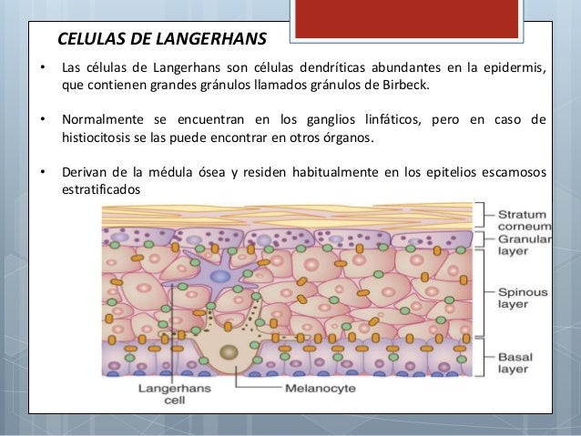 Histiocitosis x langerhans