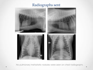 Radiographs  sent	
No pulmonary metastatic nodules were seen on chest radiographs
 