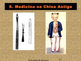 6. Medicina na China Antiga 
Salomão Kahwage 31 
 