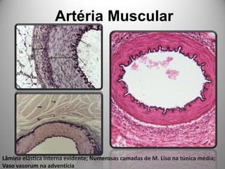 Artéria MuscularLâmina elástica interna evidente; Numerosas camadas de M. Liso na túnica média; Vaso vasorum na adventícia