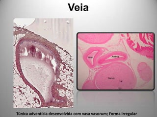 VeiaTúnica adventícia desenvolvida com vasa vasorum; Forma irregular