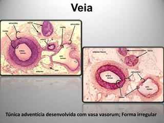 VeiaTúnica adventícia desenvolvida com vasa vasorum; Forma irregular
