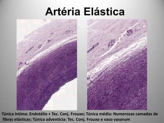 Artéria ElásticaTúnica íntima: Endotélio + Tec. Conj. Frouxo; Túnica média: Numerosas camadas de fibras elásticas; Túnica adventícia: Tec. Conj. Frouxo e vaso vasorum