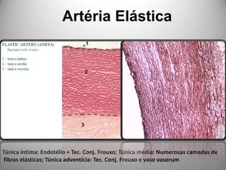 Artéria ElásticaTúnica íntima: Endotélio + Tec. Conj. Frouxo; Túnica média: Numerosas camadas de fibras elásticas; Túnica adventícia: Tec. Conj. Frouxo e vaso vasorum