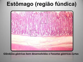 Estômago (região fúndica)Glândulas gástricas bem desenvolvidas e Fossetas gástricas curtas