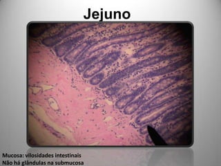 JejunoMucosa: vilosidades intestinais Não há glândulas na submucosa