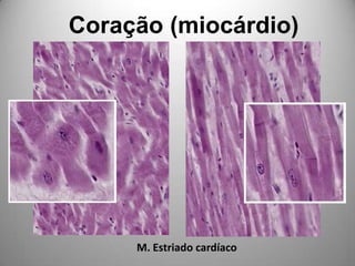 Coração (miocárdio)M. Estriado cardíaco