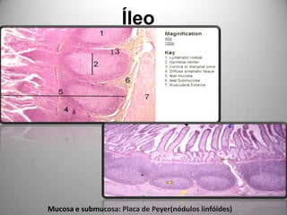 ÍleoMucosa e submucosa: Placa de Peyer(nódulos linfóides)