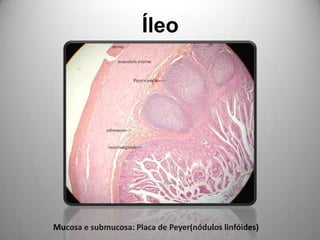 ÍleoMucosa e submucosa: Placa de Peyer(nódulos linfóides)