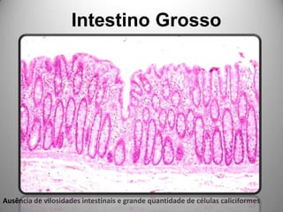 Intestino Grosso Ausência de vilosidades intestinais e grande quantidade de células caliciformes