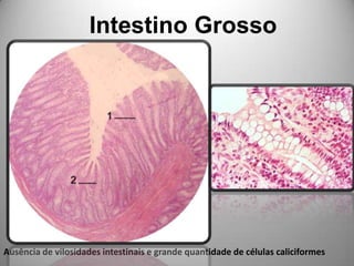 Intestino Grosso Ausência de vilosidades intestinais e grande quantidade de células caliciformes