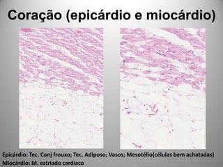 Coração (epicárdio e miocárdio)Epicárdio: Tec. Conj frouxo; Tec. Adiposo; Vasos; Mesotélio(células bem achatadas)Miocárdio: M. estriado cardíaco