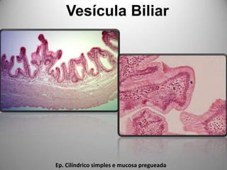 Vesícula BiliarEp. Cilíndrico simples e mucosa pregueada