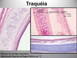 TraquéiaMucosa: Ep. do tipo respiratórioSubmucosa: Peça de cartilagem hialina em “C”