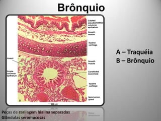 Brônquio A – TraquéiaB – BrônquioPeças de carilagem hialina separadasGlândulas seromucosas