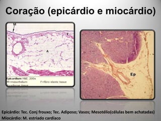 Coração (epicárdio e miocárdio)Epicárdio: Tec. Conj frouxo; Tec. Adiposo; Vasos; Mesotélio(células bem achatadas)Miocárdio: M. estriado cardíaco