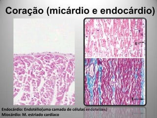 Coração (micárdio e endocárdio)Endocárdio: Endotélio(uma camada de células endoteliais)Miocárdio: M. estriado cardíaco 