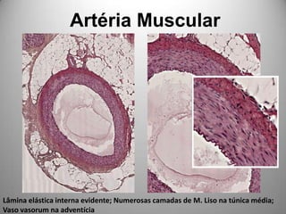 Artéria MuscularLâmina elástica interna evidente; Numerosas camadas de M. Liso na túnica média; Vaso vasorum na adventícia