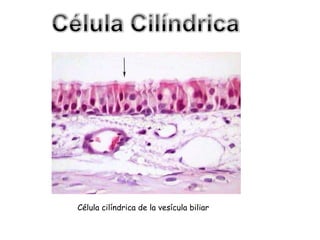 Célula cilíndrica de la vesícula biliar 