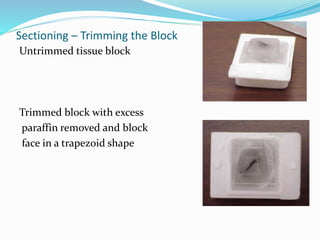 Sectioning – Trimming the Block
Untrimmed tissue block
Trimmed block with excess
paraffin removed and block
face in a trapezoid shape
 