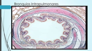 Bronquios Intrapulmonares
 
