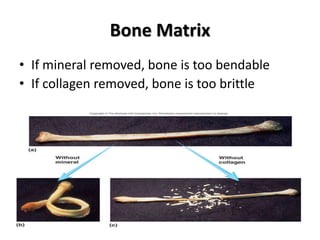 Bone Matrix
• If mineral removed, bone is too bendable
• If collagen removed, bone is too brittle
 