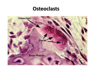 Osteoclasts
 